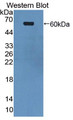 Western Blot; Sample: Recombinant protein. Western Blot; Sample: Recombinant protein.