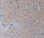 Used in DAB staining on fromalin fixed paraffin- embedded brain tissue Used in DAB staining on fromalin fixed paraffin- embedded brain tissue