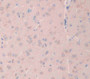 CREB Binding Protein (CREBBP) Polyclonal Antibody, Cat#CAU22941 CREB Binding Protein (CREBBP) Polyclonal Antibody, Cat#CAU22941
