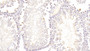 DAB staining on IHC-P; Samples: Rat Testis Tissue;  Primary Ab: 20μg/ml Rabbit Anti-Rat GPX5 Antibody Second Ab: 2µg/mL HRP-Linked Caprine Anti-Rabbit IgG Polyclonal Antibody  DAB staining on IHC-P; Samples: Rat Testis Tissue;  Primary Ab: 20μg/ml Rabbit Anti-Rat GPX5 Antibody Second Ab: 2µg/mL HRP-Linked Caprine Anti-Rabbit IgG Polyclonal Antibody