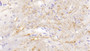DAB staining on IHC-P; Samples: Mouse Spinal cord Tissue;  Primary Ab: 10μg/ml Rabbit Anti-Mouse CTSG Antibody Second Ab: 2µg/mL HRP-Linked Caprine Anti-Rabbit IgG Polyclonal Antibody  DAB staining on IHC-P; Samples: Mouse Spinal cord Tissue;  Primary Ab: 10μg/ml Rabbit Anti-Mouse CTSG Antibody Second Ab: 2µg/mL HRP-Linked Caprine Anti-Rabbit IgG Polyclonal Antibody
