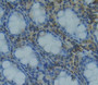 Used in DAB staining on fromalin fixed paraffin- embedded rectum tissue Used in DAB staining on fromalin fixed paraffin- embedded rectum tissue