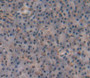 Liver Receptor Homolog 1 (LRH1) Polyclonal Antibody, Cat#CAU22958 Liver Receptor Homolog 1 (LRH1) Polyclonal Antibody, Cat#CAU22958