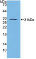 Western Blot; Sample: Recombinant RARb, Human. Western Blot; Sample: Recombinant RARb, Human.