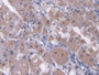 DAB staining on IHC-P; Samples: Human Stomach Tissue; Primary Ab: 20µg/ml Rabbit Anti-Human RARb Antibody Second Ab: 2µg/mL HRP-Linked Caprine Anti-Rabbit IgG Polyclonal Antibody DAB staining on IHC-P; Samples: Human Stomach Tissue; Primary Ab: 20µg/ml Rabbit Anti-Human RARb Antibody Second Ab: 2µg/mL HRP-Linked Caprine Anti-Rabbit IgG Polyclonal Antibody