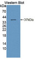Western Blot; Sample: Recombinant protein.