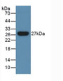 Western Blot; Sample: Human Urine. Western Blot; Sample: Human Urine.