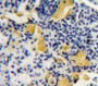 Used in DAB staining on fromalin fixed paraffin-embedded Bowels tissue Used in DAB staining on fromalin fixed paraffin-embedded Bowels tissue