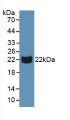 Western Blot; Sample: Human Urine. Western Blot; Sample: Human Urine.
