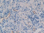 DAB staining on IHC-P; Samples: Mouse Kidney Tissue; Primary Ab: 10µg/ml Rabbit Anti-Mouse TNFSF9 Antibody Second Ab: 2µg/mL HRP-Linked Caprine Anti-Rabbit IgG Polyclonal Antibody DAB staining on IHC-P; Samples: Mouse Kidney Tissue; Primary Ab: 10µg/ml Rabbit Anti-Mouse TNFSF9 Antibody Second Ab: 2µg/mL HRP-Linked Caprine Anti-Rabbit IgG Polyclonal Antibody