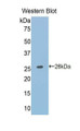 Western Blot; Sample: Recombinant protein. Western Blot; Sample: Recombinant protein.