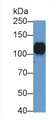 Western Blot; Sample: Recombinant protein. Western Blot; Sample: Recombinant protein.