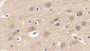 DABstainingonIHC-P.Samples:HumanTissue) DABstainingonIHC-P.Samples:HumanTissue)