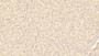 DAB staining on IHC-P; Samples: Human Liver Tissue; Primary Ab: 20μg/ml Rabbit Anti-Human TNFRSF19 Antibody Second Ab: 2µg/mL HRP-Linked Caprine Anti-Rabbit IgG Polyclonal Antibody DAB staining on IHC-P; Samples: Human Liver Tissue; Primary Ab: 20μg/ml Rabbit Anti-Human TNFRSF19 Antibody Second Ab: 2µg/mL HRP-Linked Caprine Anti-Rabbit IgG Polyclonal Antibody
