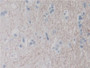 DAB staining on IHC-P; Samples: Human Cerebrum Tissue; Primary Ab: 30µg/ml Rabbit Anti-Human DPP8 Antibody Second Ab: 2µg/mL HRP-Linked Caprine Anti-Rabbit IgG Polyclonal Antibody DAB staining on IHC-P; Samples: Human Cerebrum Tissue; Primary Ab: 30µg/ml Rabbit Anti-Human DPP8 Antibody Second Ab: 2µg/mL HRP-Linked Caprine Anti-Rabbit IgG Polyclonal Antibody