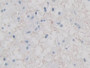 DABstainingonIHC-P.Samples:HumanTissue) DABstainingonIHC-P.Samples:HumanTissue)