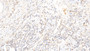 DAB staining on fromalin fixed paraffin- embedded rectum tissue) DAB staining on fromalin fixed paraffin- embedded rectum tissue)