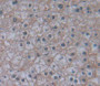 Used in DAB staining on fromalin fixed paraffin- embedded liver tissue Used in DAB staining on fromalin fixed paraffin- embedded liver tissue