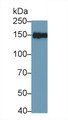 Western Blot; Sample: MCF7 cell lysate; Primary Ab: 2µg/ml Rabbit Anti-Human IRS2 Antibody; Second Ab: 0.2µg/mL HRP-Linked Caprine Anti-Rabbit IgG Polyclonal Antibody; Western Blot; Sample: MCF7 cell lysate; Primary Ab: 2µg/ml Rabbit Anti-Human IRS2 Antibody; Second Ab: 0.2µg/mL HRP-Linked Caprine Anti-Rabbit IgG Polyclonal Antibody;