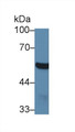 Western Blot; Sample: Mouse Cerebrum lysate; Primary Ab: 1µg/ml Rabbit Anti-Mouse ABAT Antibody Second Ab: 0.2µg/mL HRP-Linked Caprine Anti-Rabbit IgG Polyclonal Antibody Western Blot; Sample: Mouse Cerebrum lysate; Primary Ab: 1µg/ml Rabbit Anti-Mouse ABAT Antibody Second Ab: 0.2µg/mL HRP-Linked Caprine Anti-Rabbit IgG Polyclonal Antibody