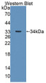 Western Blot; Sample: Recombinant protein. Western Blot; Sample: Recombinant protein.