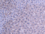DAB staining on IHC-P; Samples: Mouse Liver Tissue DAB staining on IHC-P; Samples: Mouse Liver Tissue