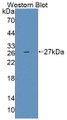 Western Blot; Sample: Recombinant protein. Western Blot; Sample: Recombinant protein.