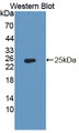 Western Blot; Sample: Recombinant protein. Western Blot; Sample: Recombinant protein.