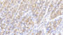 DAB staining on IHC-P; Samples: Human Stomach Tissue; Primary Ab: 20μg/ml Rabbit Anti-Human PDP2 Antibody Second Ab: 2µg/mL HRP-Linked Caprine Anti-Rabbit IgG Polyclonal Antibody DAB staining on IHC-P; Samples: Human Stomach Tissue; Primary Ab: 20μg/ml Rabbit Anti-Human PDP2 Antibody Second Ab: 2µg/mL HRP-Linked Caprine Anti-Rabbit IgG Polyclonal Antibody