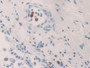 DAB staining on fromalin fixed paraffin- embedded kidney tissue) DAB staining on fromalin fixed paraffin- embedded kidney tissue)