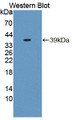 Western Blot; Sample: Recombinant protein. Western Blot; Sample: Recombinant protein.