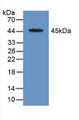 Western Blot; Sample: Recombinant ACAT2, Human. Western Blot; Sample: Recombinant ACAT2, Human.