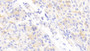 DAB staining on IHC-P; Samples: Mouse Stomach Tissue; Primary Ab: 20μg/ml Rabbit Anti-Mouse ABCD2 Antibody Second Ab: 2µg/mL HRP-Linked Caprine Anti-Rabbit IgG Polyclonal Antibody DAB staining on IHC-P; Samples: Mouse Stomach Tissue; Primary Ab: 20μg/ml Rabbit Anti-Mouse ABCD2 Antibody Second Ab: 2µg/mL HRP-Linked Caprine Anti-Rabbit IgG Polyclonal Antibody