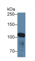 Western Blot; Sample: Human Hela cell lysate; Primary Ab: 3µg/ml Rabbit Anti-Human ABCF1 Antibody Second Ab: 0.2µg/mL HRP-Linked Caprine Anti-Rabbit IgG Polyclonal Antibody Western Blot; Sample: Human Hela cell lysate; Primary Ab: 3µg/ml Rabbit Anti-Human ABCF1 Antibody Second Ab: 0.2µg/mL HRP-Linked Caprine Anti-Rabbit IgG Polyclonal Antibody