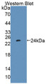 Western Blot; Sample: Recombinant protein. Western Blot; Sample: Recombinant protein.
