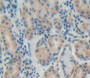 Used in DAB staining on fromalin fixed paraffin- embedded stomach tissue Used in DAB staining on fromalin fixed paraffin- embedded stomach tissue