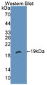 Figure. Western Blot; Sample: Recombinant PTPRZ, Mouse. Figure. Western Blot; Sample: Recombinant PTPRZ, Mouse.