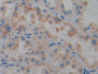 DAB staining on IHC-P; Samples: Human Kidney Tissue; Primary Ab: 10µg/ml Rabbit Anti-Human PTPRQ Antibody Second Ab: 2µg/mL HRP-Linked Caprine Anti-Rabbit IgG Polyclonal Antibody
