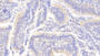 DAB staining on fromalin fixed paraffin- embedded stomach tissue) DAB staining on fromalin fixed paraffin- embedded stomach tissue)