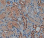 Used in DAB staining on fromalin fixed paraffin- embedded kidney tissue Used in DAB staining on fromalin fixed paraffin- embedded kidney tissue