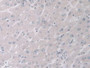 Figure. DAB staining on IHC-P; Samples: Human Liver Tissue. Figure. DAB staining on IHC-P; Samples: Human Liver Tissue.