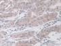 DAB staining on IHC-P; Samples: Human Liver Tissue DAB staining on IHC-P; Samples: Human Liver Tissue