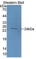 Western Blot; Sample: Recombinant protein. Western Blot; Sample: Recombinant protein.