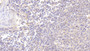 DAB staining on IHC-P; Samples: Human Spleen Tissue;  Primary Ab: 20μg/ml Rabbit Anti-Human CYP5A1 Antibody Second Ab: 2µg/mL HRP-Linked Caprine Anti-Rabbit IgG Polyclonal Antibody  DAB staining on IHC-P; Samples: Human Spleen Tissue;  Primary Ab: 20μg/ml Rabbit Anti-Human CYP5A1 Antibody Second Ab: 2µg/mL HRP-Linked Caprine Anti-Rabbit IgG Polyclonal Antibody