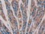DAB staining on IHC-P; Samples: Mouse Stomach Tissue;  Primary Ab: 10µg/ml Rabbit Anti-Mouse CYP24A1 DAB staining on IHC-P; Samples: Mouse Stomach Tissue;  Primary Ab: 10µg/ml Rabbit Anti-Mouse CYP24A1