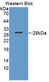 Western Blot; Sample: Recombinant protein. Western Blot; Sample: Recombinant protein.