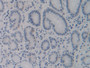 DAB staining on IHC-P; Samples: Human Stomach Tissue; Primary Ab: 10µg/ml Rabbit Anti-Human CYP24A1 Antibody Second Ab: 2µg/mL HRP-Linked Caprine Anti-Rabbit IgG Polyclonal Antibody DAB staining on IHC-P; Samples: Human Stomach Tissue; Primary Ab: 10µg/ml Rabbit Anti-Human CYP24A1 Antibody Second Ab: 2µg/mL HRP-Linked Caprine Anti-Rabbit IgG Polyclonal Antibody