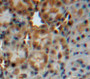 DAB staining on fromalin fixed paraffin-embedded liver tissue) DAB staining on fromalin fixed paraffin-embedded liver tissue)