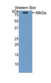 Western Blot; Sample: Recombinant protein. Western Blot; Sample: Recombinant protein.
