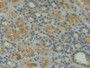 DAB staining on fromalin fixed paraffin- embedded kidney tissue) DAB staining on fromalin fixed paraffin- embedded kidney tissue)